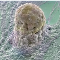 FDA Approves Landmark Stem Cell Study