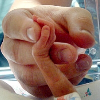Why Does the U.S. Have Such a High Infant Mortality Rate?