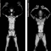 Body and Vehicle Scanners Spreading and Using Higher Doses of Radiation
