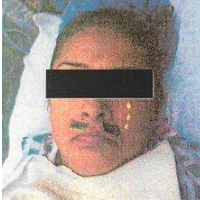 Doctor Sued for Decorating Patient’s Face with Stickers in Surgery