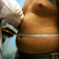 Overweight—But Not Obese—People Have a Lower Mortality Rate than Those of Normal Weight
