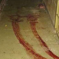 Doctors Working for U.S. Military Took Part in Detainee Torture, and Army Field Manual Still Allows It