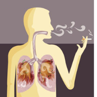 Cigarette Smoking is linked to 25% of All Cancer Deaths in U.S.
