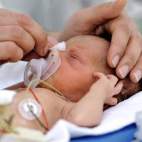 Calcium Buildup in Womb Seen as Possible Cause of Premature Births