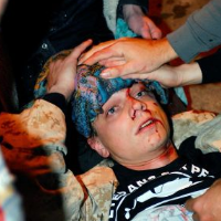 Iraq War Vet, Skull Fractured by Oakland Police, Wins $4.5 Million Award