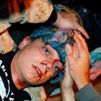 Police Fracture Skull of Iraq War Veteran While Clearing Out Occupy Oakland Protestors