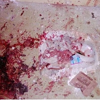 What’s In the Photos Obama Won’t Release?