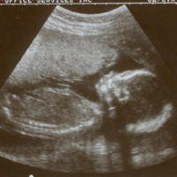 Republican Dissent Killed Controversial House Abortion Bill, but Clones Emerge in State Legislatures