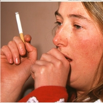 Is It Time to Limit Nicotine Levels in Cigarettes?