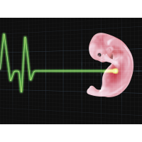 Arkansas Set to Impose Nation’s Most Restrictive Abortion Law