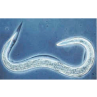 Parasitic Worms Found in Sushi Can Detect Cancer in People by Smelling it in Their Urine