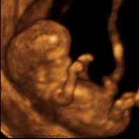 Montana Woman Charged with Child Endangerment for Taking Drugs While 12 Weeks Pregnant