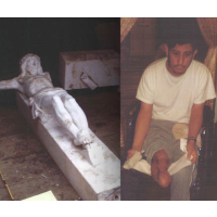 Man Sues after Losing Leg to Falling Crucifix