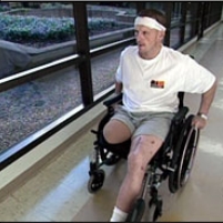 Number of Americans Wounded in Iraq is Obscured by Fog of War…and Peace