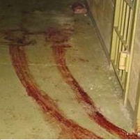 Obama and Holder Drop 99 of 101 CIA Torture Cases