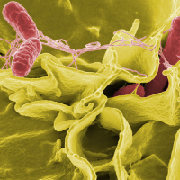 Contaminated Food Illness: No Overall Progress in 7 Years