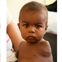 Did Virginia Company’s Coal Ash Cause Birth Defects in Dominican Republic?