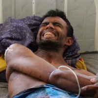 While U.S. Confronts Painkiller Addiction Epidemic, Drugs’ Absence around World Leaves Many Suffering