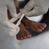 Cholera Epidemic in Haiti Caused by U.N.