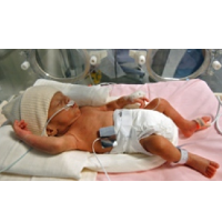 U.S. Preterm Birth Rate Drops to 17-Year Low