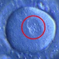 Iowa Republicans Introduce Bill Criminalizing “Murder” of Zygotes