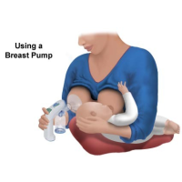 Big Winner in Obamacare…Breast Pump Industry