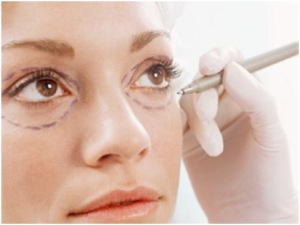 Should Medicare Pay for Eyelid Lift Surgery?