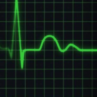 Those on High-Deductible Health Plans Often Do Without Medical Care