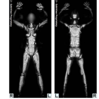 TSA Ignores Year-Old Court Order to Regulate the Use of “Nude” Body Scanners