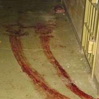 Unearthed Corpse of Afghan Torture Victim Ignites Controversy over American Involvement