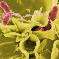 Contaminated Food Costs U.S. More Than $14 Billion a Year