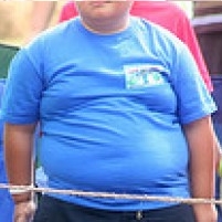 Some Cases of Obesity Linked to Urban Air Pollution