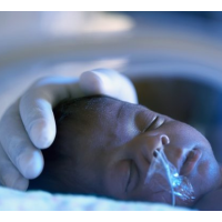 U.S. Failing to Keep Babies Alive; Tens of Thousands Die Annually