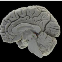 Obama to Propose Funding of Billion-Dollar Brain-Mapping Project