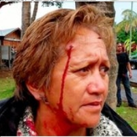 25 Injured in a Protest…Far, Far Away