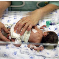 Parents Accuse Alabama Hospital of Using Premature Babies for Dangerous Medical Study
