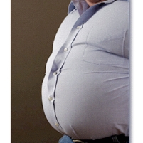 Obesity May Cost U.S. $215 Billion a Year
