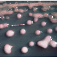 23,000 Americans Die Annually from Antibiotic-Resistant Infections
